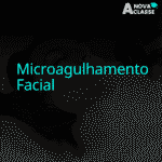 Microagulhamento Facial